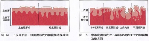 口腔内の粘膜の図