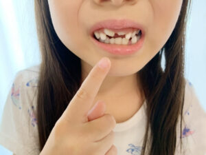 永久歯の前歯について